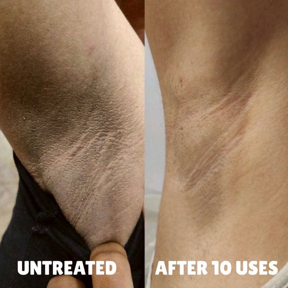 before after 1