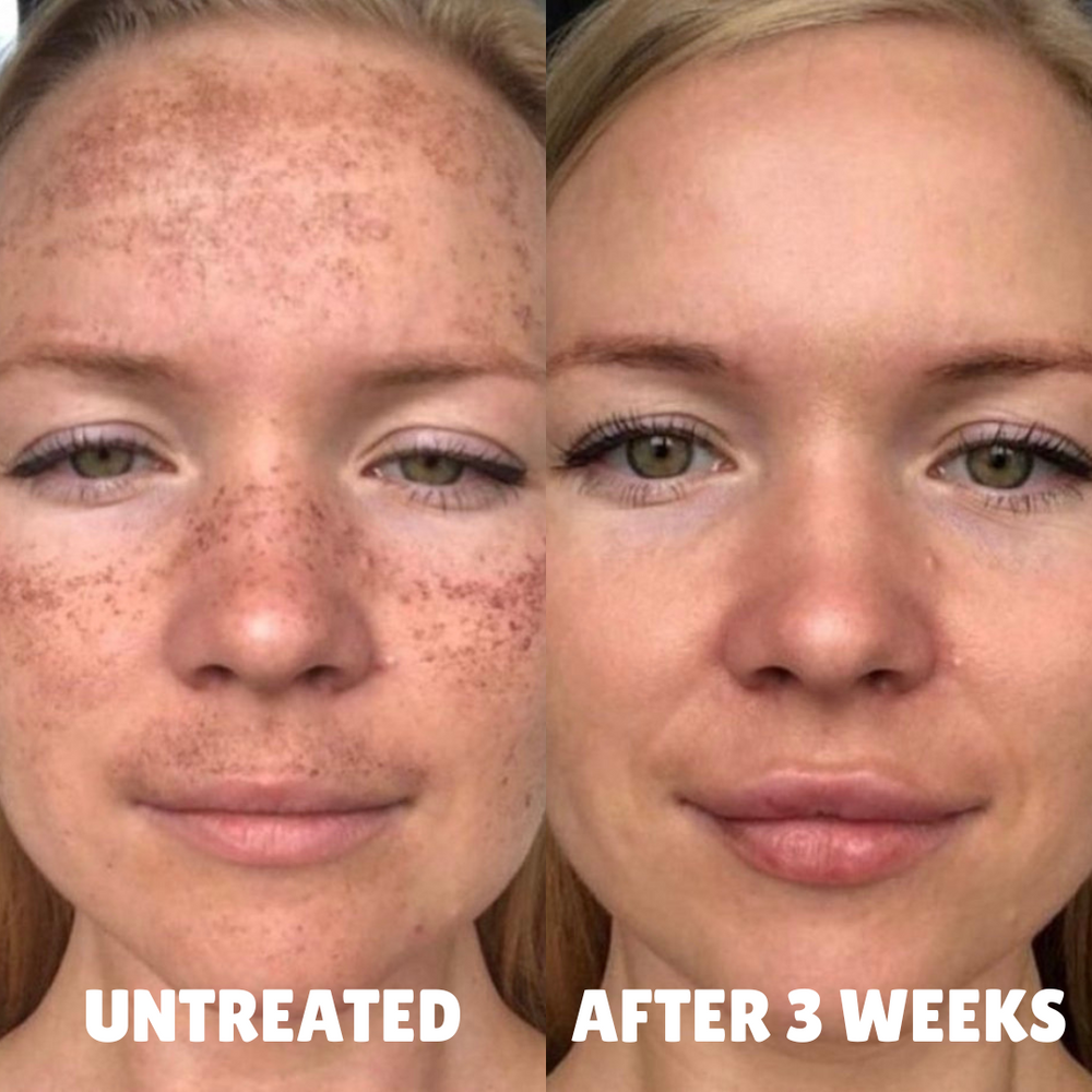 before after 3