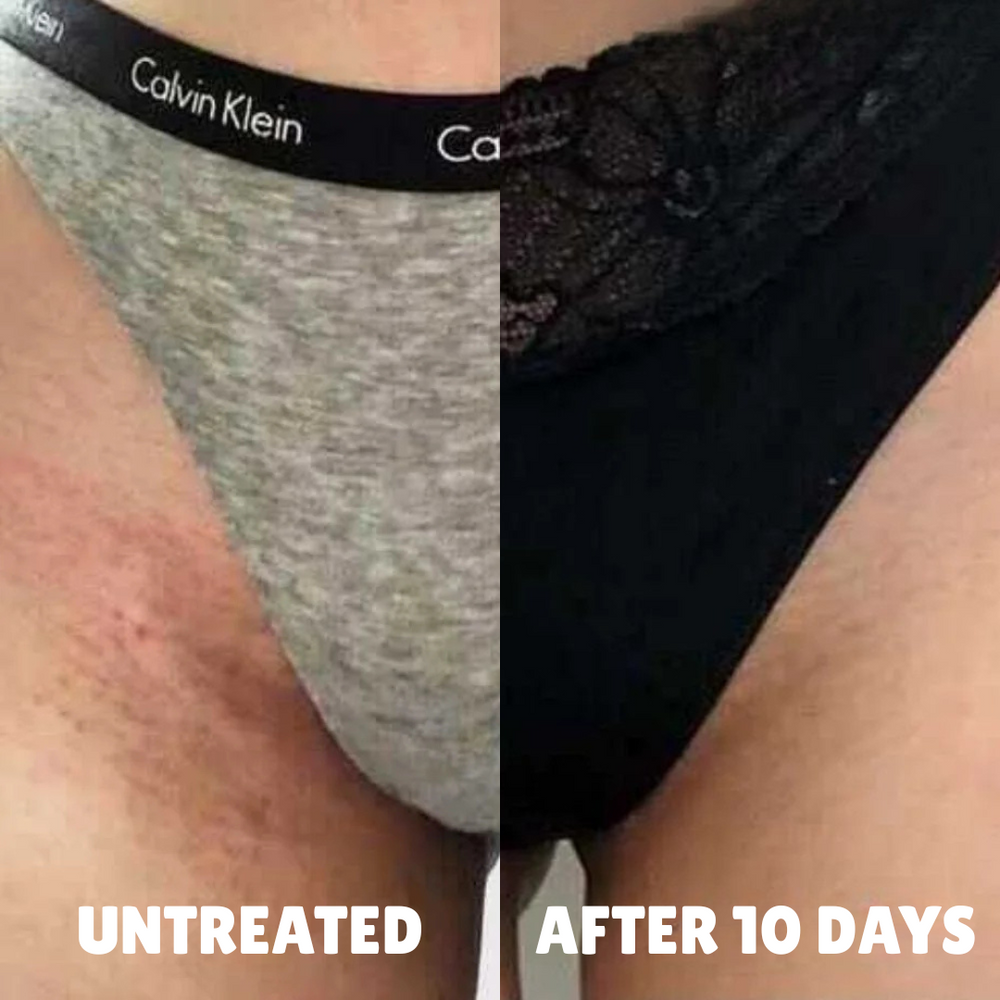 before after 4